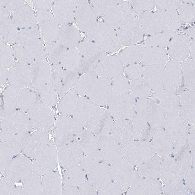 Staining of human skeletal muscle shows low expression as expected.