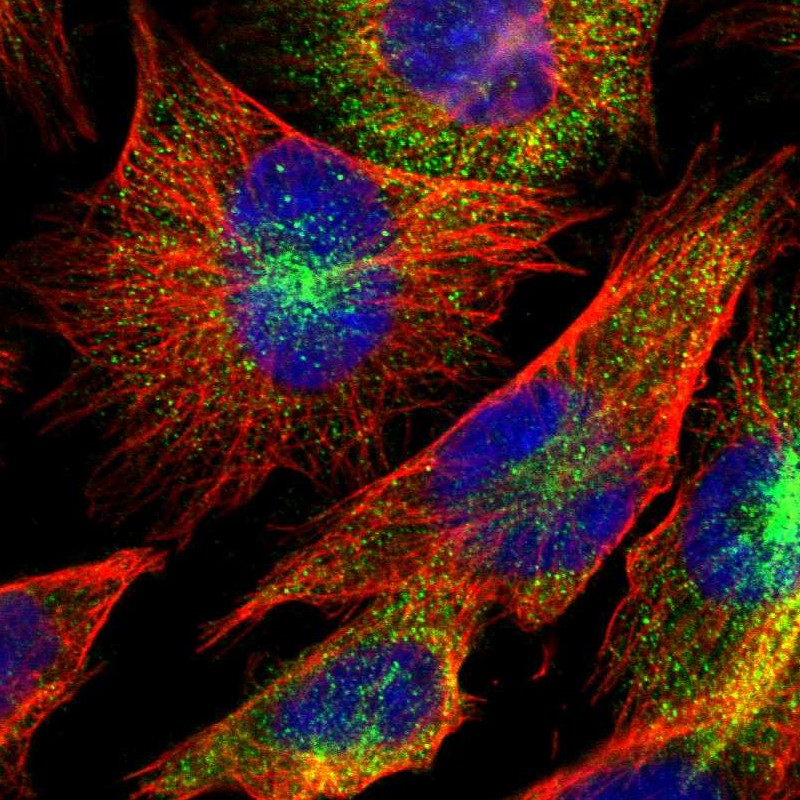 Staining of human cell line U-251 MG shows localization to cytosol.
