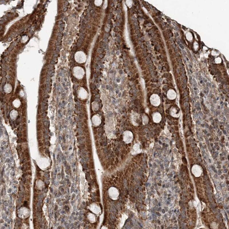 Immunohistochemistry-Paraffin RASSF8 Antibody - BSA Free
