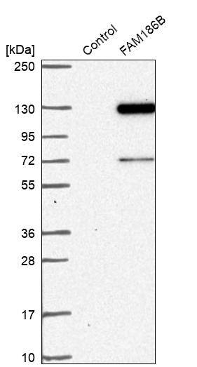 Analysis in control (vector only transfected HEK293T lysate) and FAM186B over-expression lysate (Co-expressed with a C-terminal myc-DDK tag (~3.1 kDa) in mammalian HEK293T cells).