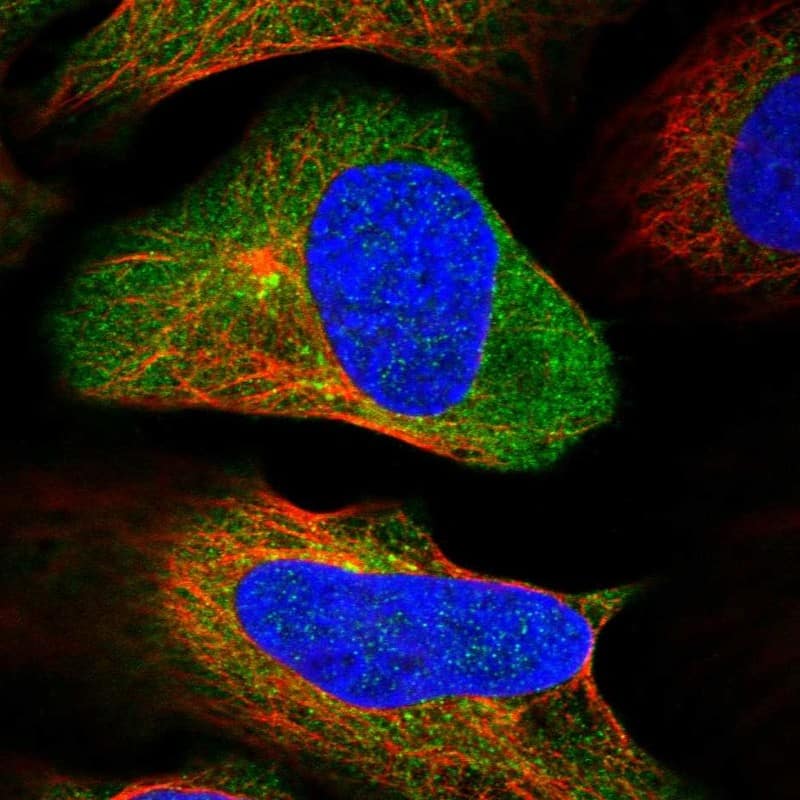 Immunocytochemistry/ Immunofluorescence NAA25 Antibody - BSA Free
