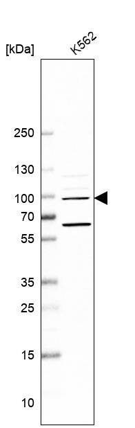 Western Blot NAA25 Antibody - BSA Free