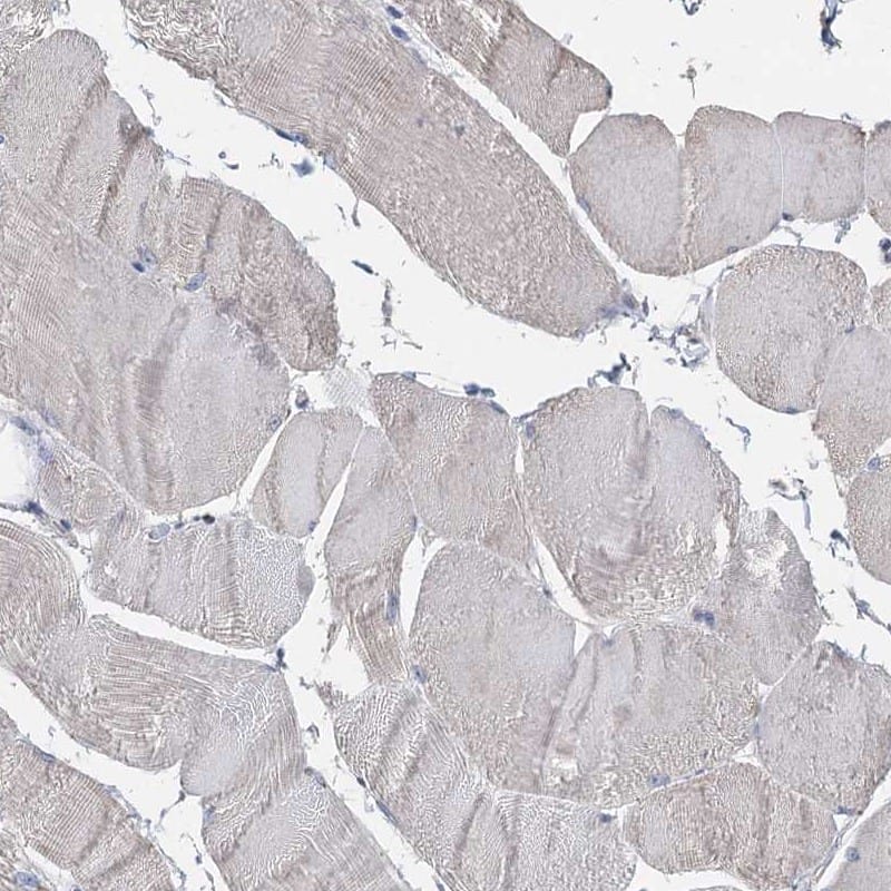 Immunohistochemistry-Paraffin TCTN2 Antibody - BSA Free