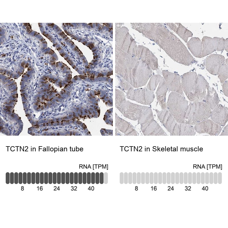 Analysis in human fallopian tube and skeletal muscle tissues.