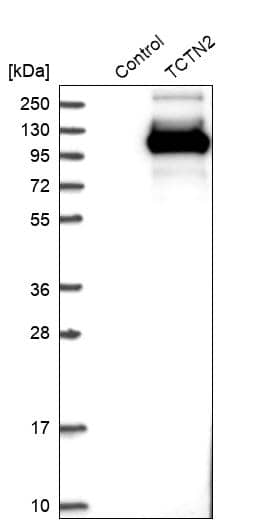 Analysis in control (vector only transfected HEK293T lysate) and TCTN2 over-expression lysate (Co-expressed with a C-terminal myc-DDK tag (~3.1 kDa) in mammalian HEK293T cells).