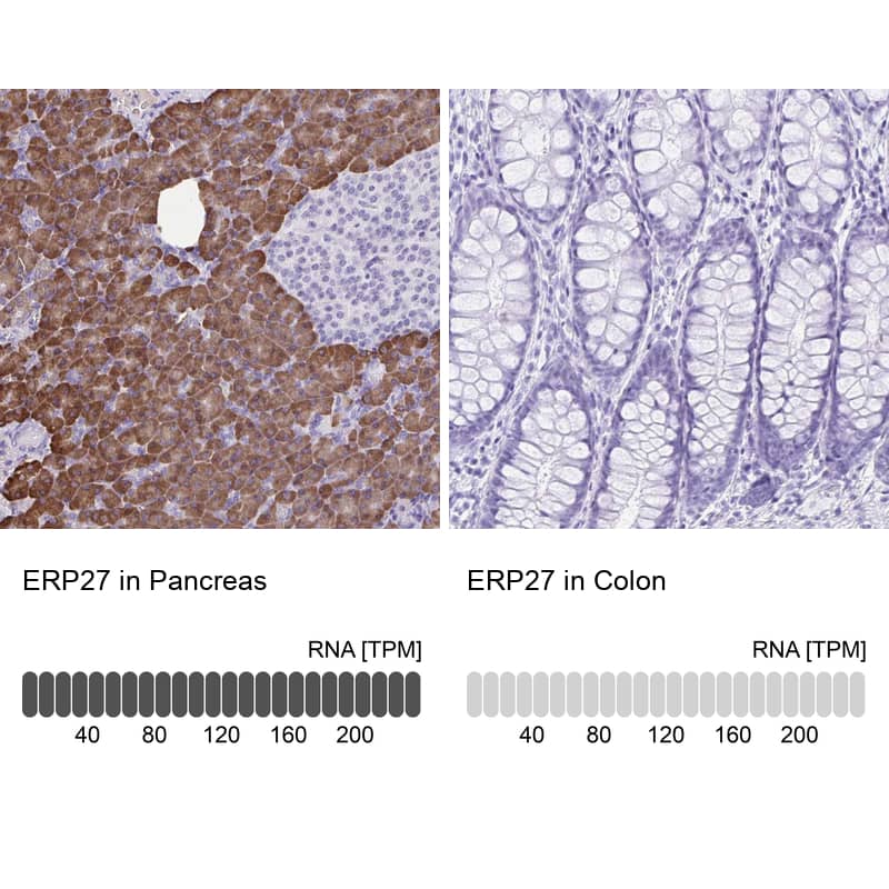 Immunohistochemistry-Paraffin ERP27 Antibody - BSA Free