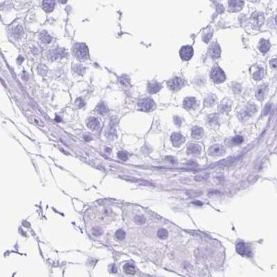 Immunohistochemistry-Paraffin ERP27 Antibody - BSA Free