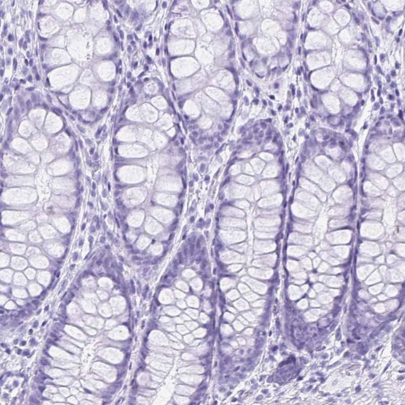 Immunohistochemistry-Paraffin ERP27 Antibody - BSA Free