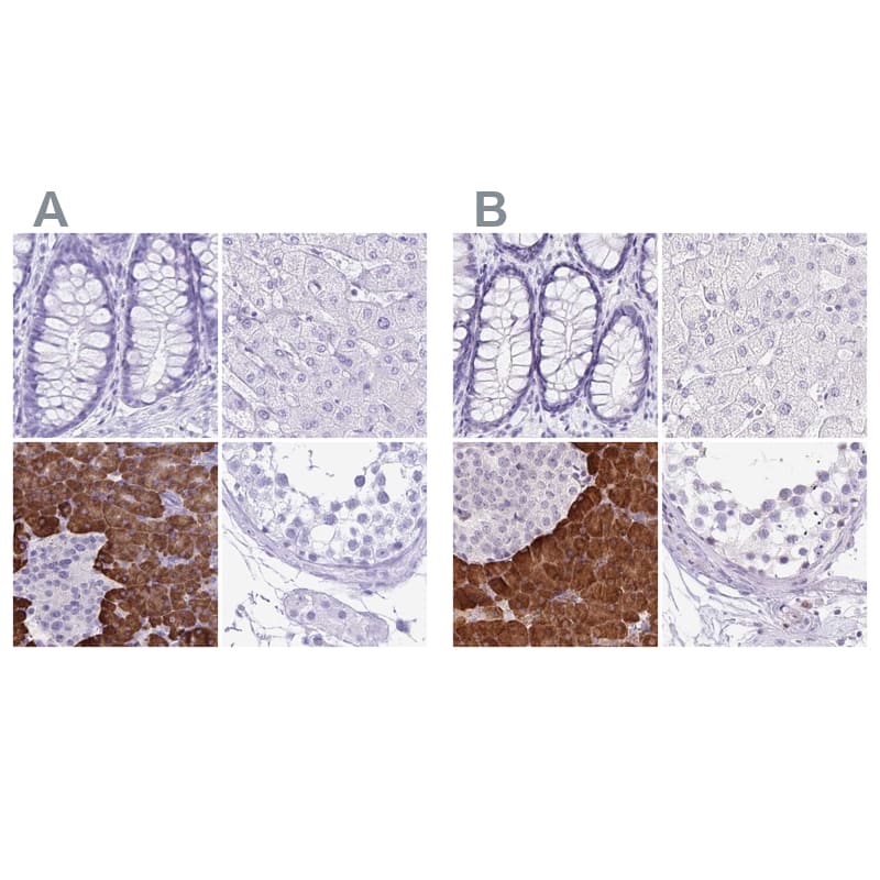 Immunohistochemistry-Paraffin ERP27 Antibody - BSA Free
