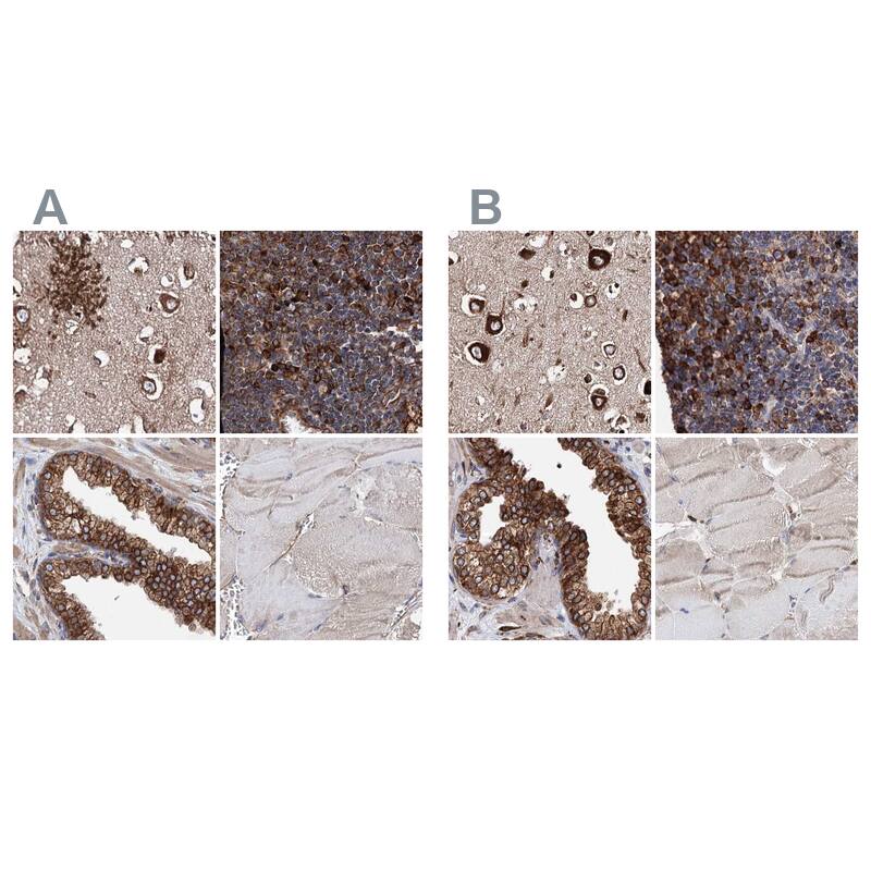 <b>Orthogonal Strategies Validation. </b>Staining of human cerebral cortex, lymph node, prostate and skeletal muscle HPA039363 (A) shows similar protein distribution across tissues to independent antibody HPA039456 (B).