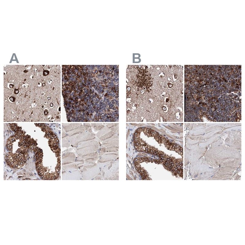 <b>Orthogonal Strategies Validation. </b>Staining of human cerebral cortex, lymph node, prostate and skeletal muscle HPA039456 (A) shows similar protein distribution across tissues to independent antibody HPA039363 (B).