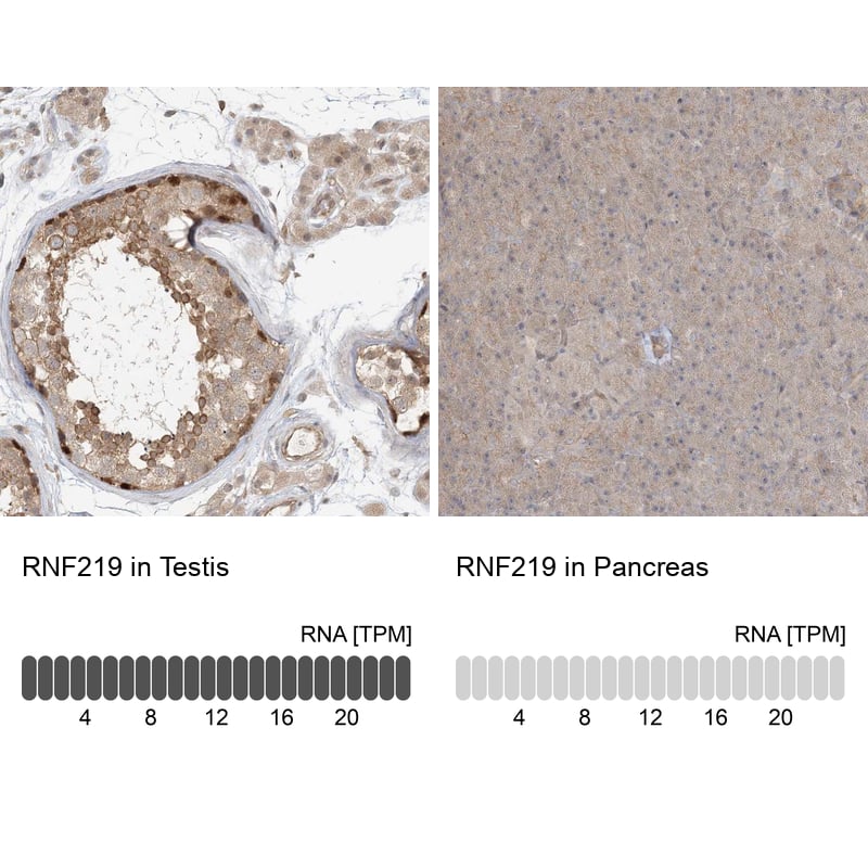 <b>Orthogonal Strategies Validation. </b>Analysis in human testis and pancreas tissues.