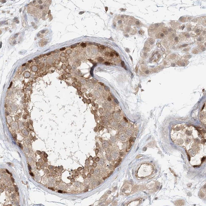 Staining of human testis shows high expression.