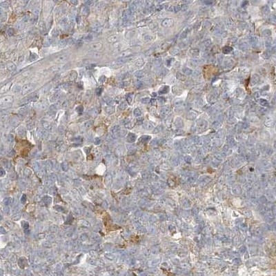 Staining of human lymph node.