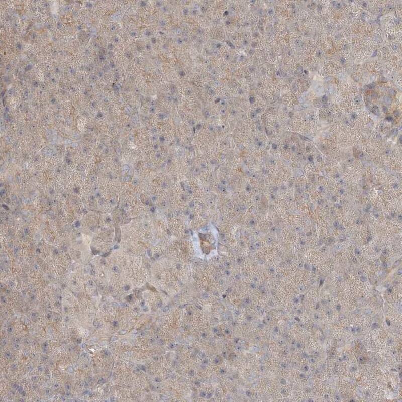 Staining of human pancreas shows low expression as expected.