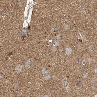 Staining of human cerebral cortex.