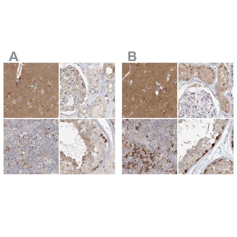 <b>Orthogonal Strategies Validation. </b>Staining of human cerebral cortex, kidney, lymph node and testis HPA034785 (A) shows similar protein distribution across tissues to independent antibody HPA034786 (B).