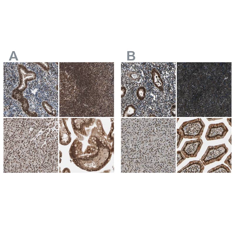 Staining of human endometrium, lymph node, pancreas and small intestine using Anti-CHAMP1 antibody NBP1-88402 (A) shows similar protein distribution across tissues to independent antibody NBP1-88403 (B).