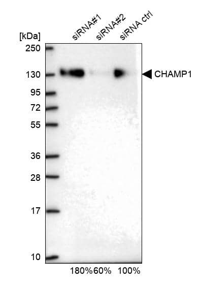 Analysis in U2OS cells transfected with control siRNA, target specific siRNA probe #1 and #2, using Anti-CHAMP1 antibody. Remaining relative intensity is presented.