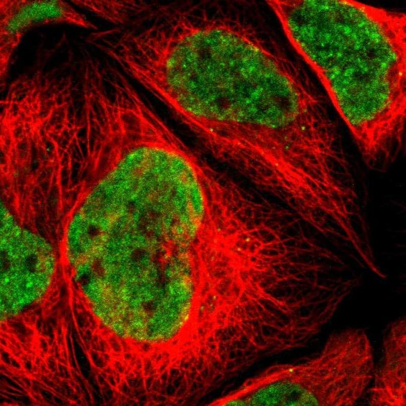 Staining of human cell line A-431 shows localization to nucleoplasm.