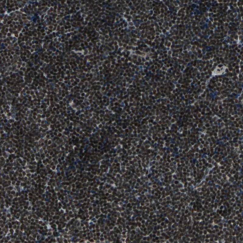 Staining of human lymph node shows strong nuclear positivity in non-germinal center cells and germinal center cells.