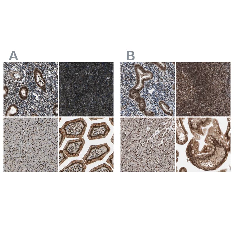 <b>Independent Antibodies Validation. </b>Staining of human endometrium, lymph node, pancreas and small intestine using Anti-CHAMP1 antibody NBP1-88403 (A) shows similar protein distribution across tissues to independent antibody NBP1-88402 (B).