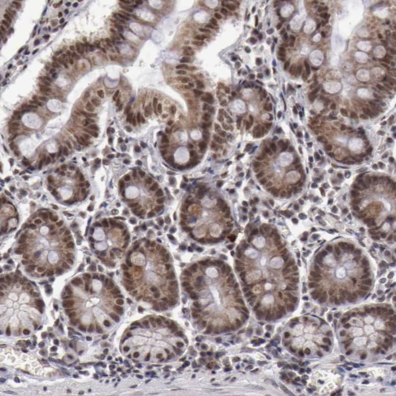 Staining of human small intestine shows nuclear and cytoplasmic positivity in glandular cells.