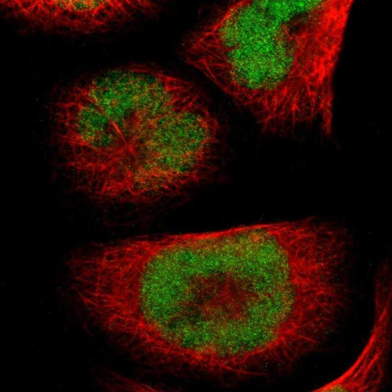 Immunocytochemistry/ Immunofluorescence UBR7 Antibody - BSA Free