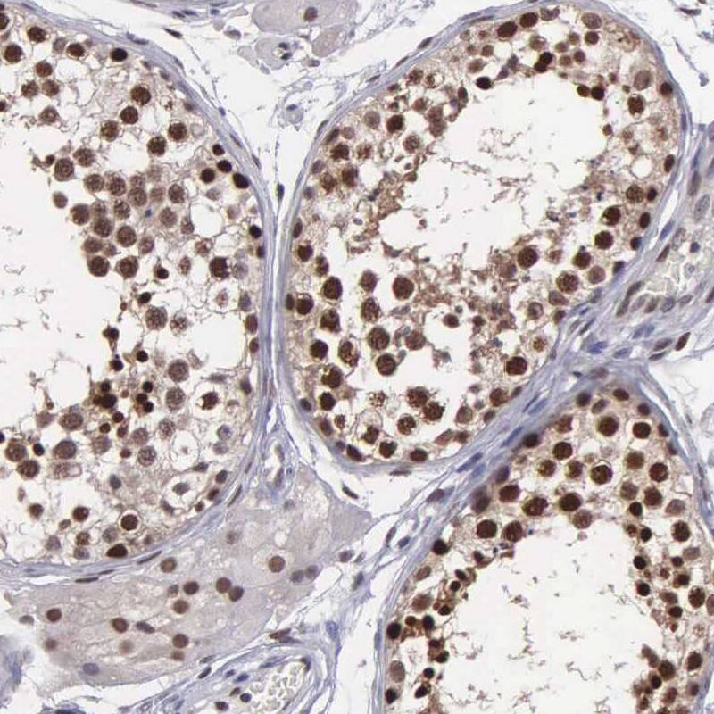 Immunohistochemistry-Paraffin UBR7 Antibody - BSA Free