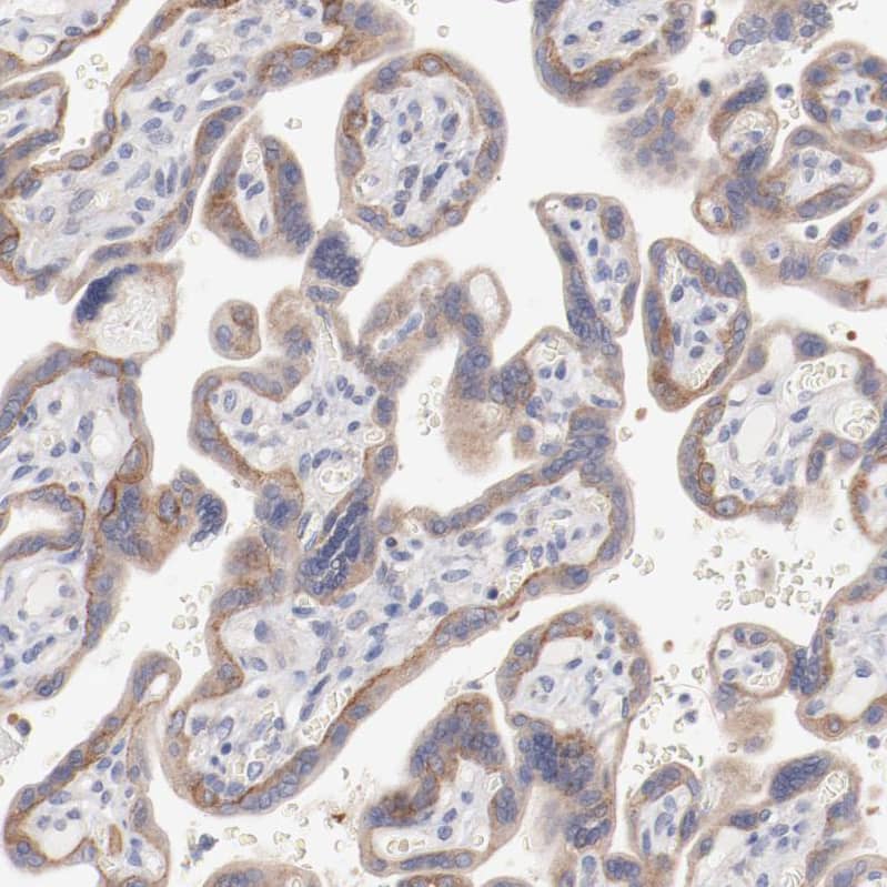 Staining of human placenta shows moderate cytoplasmic positivity in trophoblastic cells.
