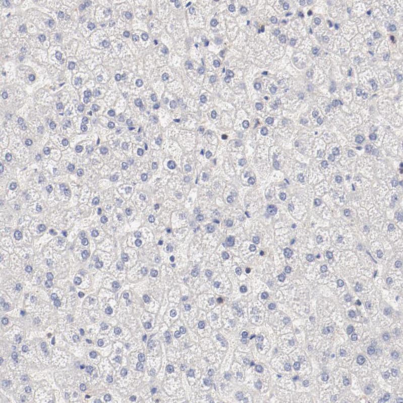Staining of human liver shows no expression in hepatocytes as expected.