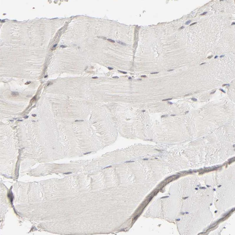 Immunohistochemistry-Paraffin SCFD1 Antibody - BSA Free