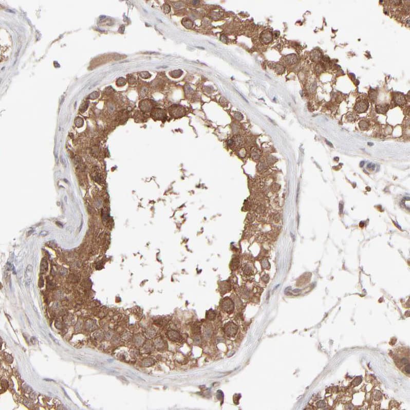 Immunohistochemistry-Paraffin SCFD1 Antibody - BSA Free