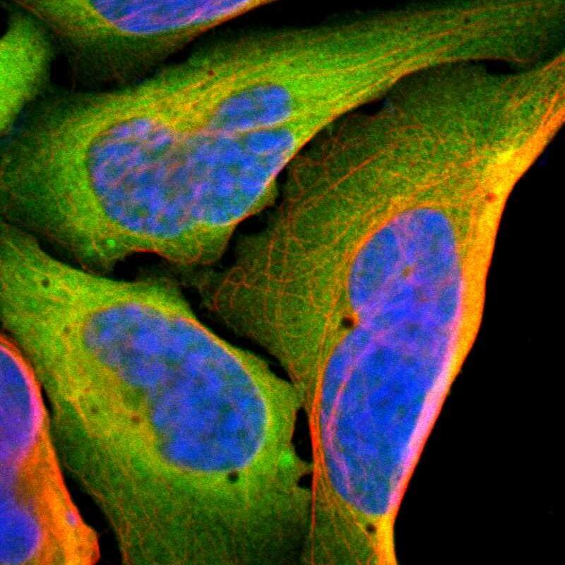 Staining of human cell line U-2 OS shows localization to cytosol.