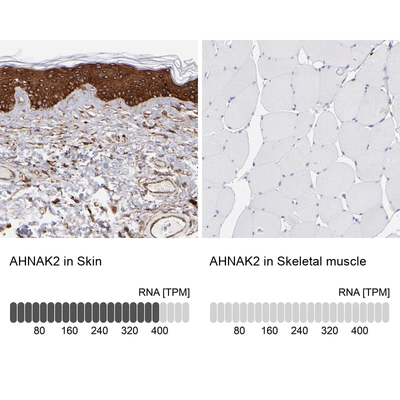 <b>Orthogonal Strategies Validation. </b>Analysis in human skin and skeletal muscle tissues using HPA002940 antibody. Corresponding AHNAK2 RNA-seq data are presented for the same tissues.