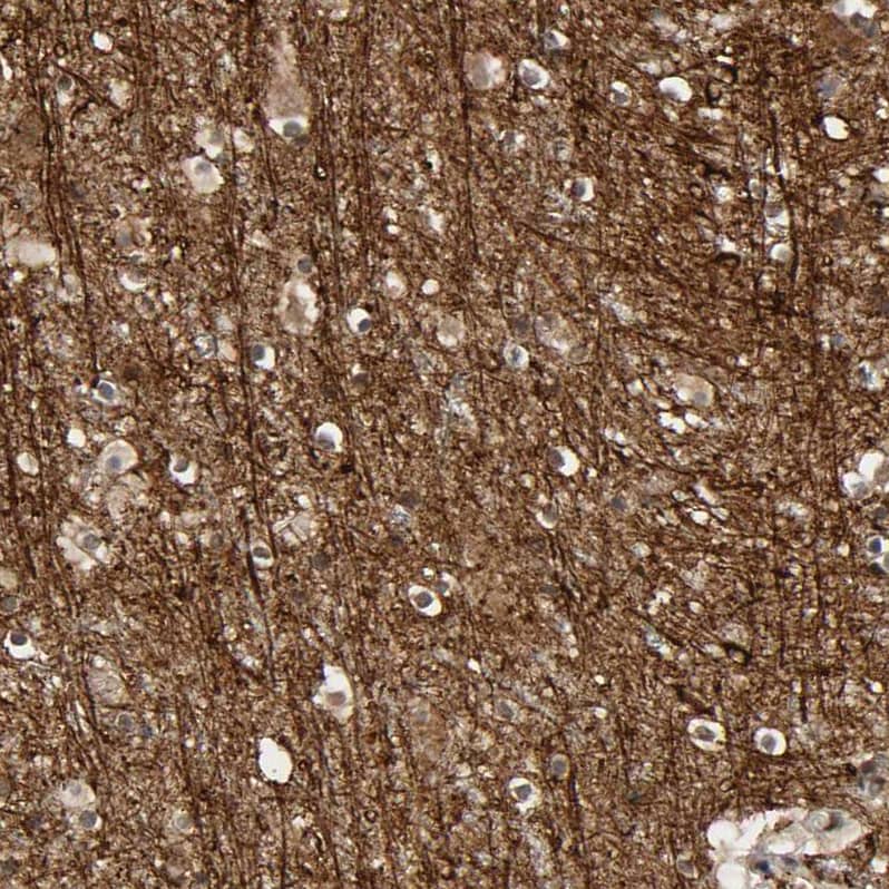 Staining of human cerebral cortex shows strong positivity in neuropil.