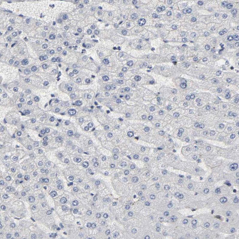 Staining of human liver shows no cytoplasmic positivity in hepatocytes as expected.