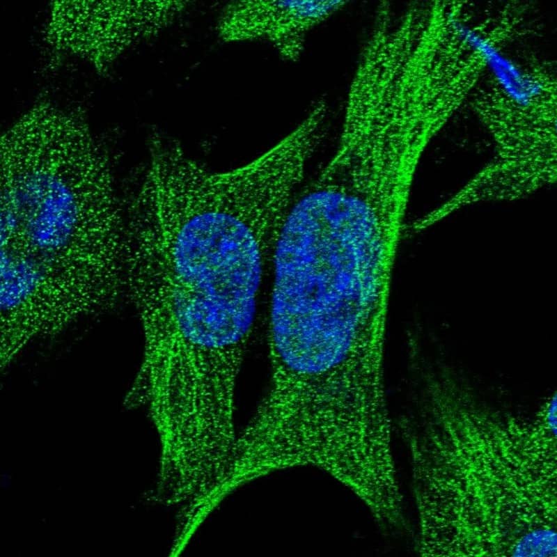 Staining of human cell line U-251 MG shows localization to nucleoplasm & microtubules.