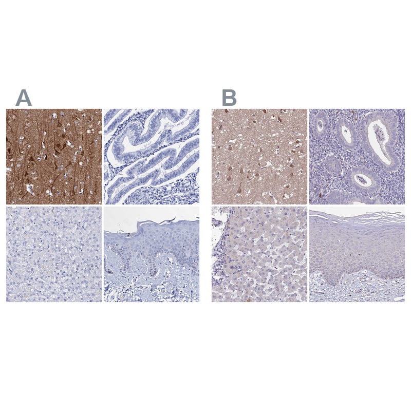 <b>Orthogonal Strategies Validation. </b>Staining of human cerebral cortex, endometrium, liver and skin HPA039504 (A) shows similar protein distribution across tissues to independent antibody HPA056354 (B).