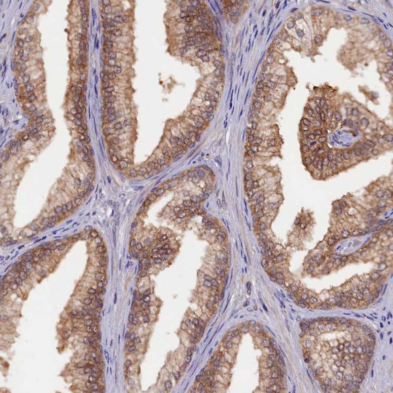 Immunohistochemistry-Paraffin HN1L Antibody - BSA Free