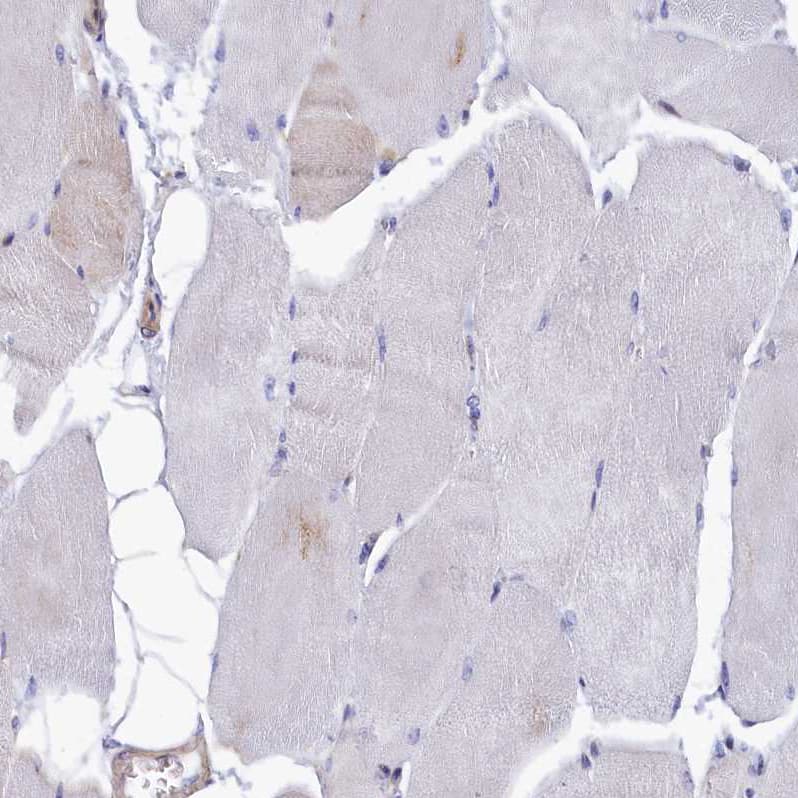 Immunohistochemistry-Paraffin HN1L Antibody - BSA Free