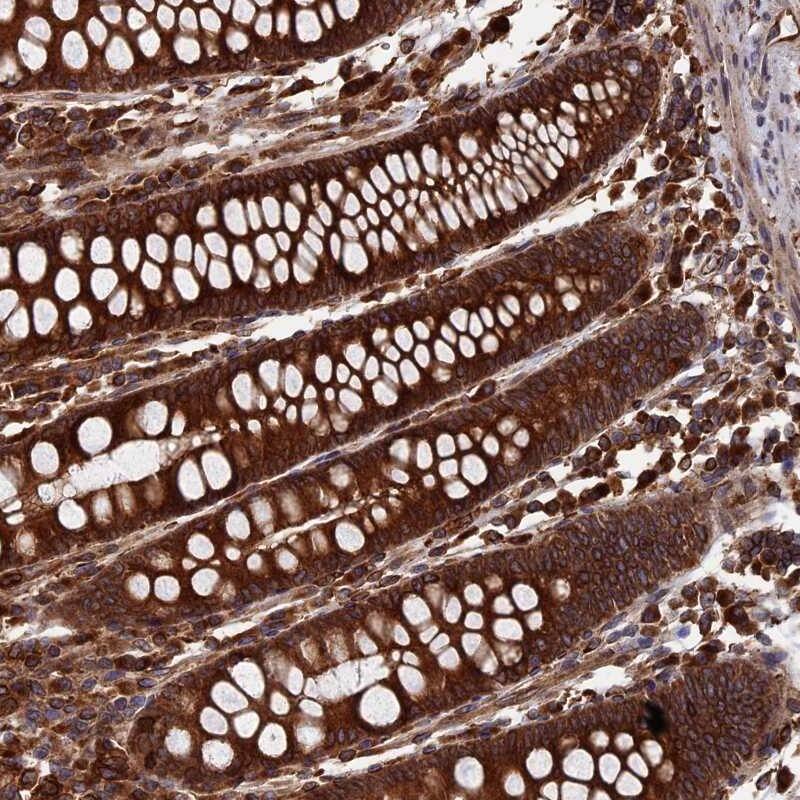 Staining of human colon shows strong cytoplasmic positivity in glandular cells.