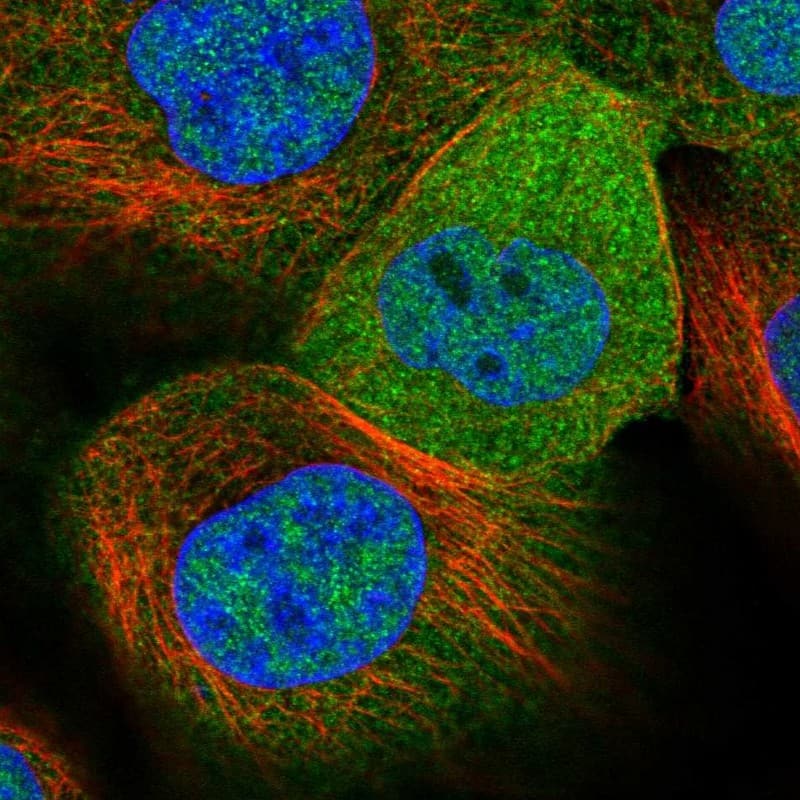 Staining of human cell line A-431 shows localization to nucleoplasm & cytosol.