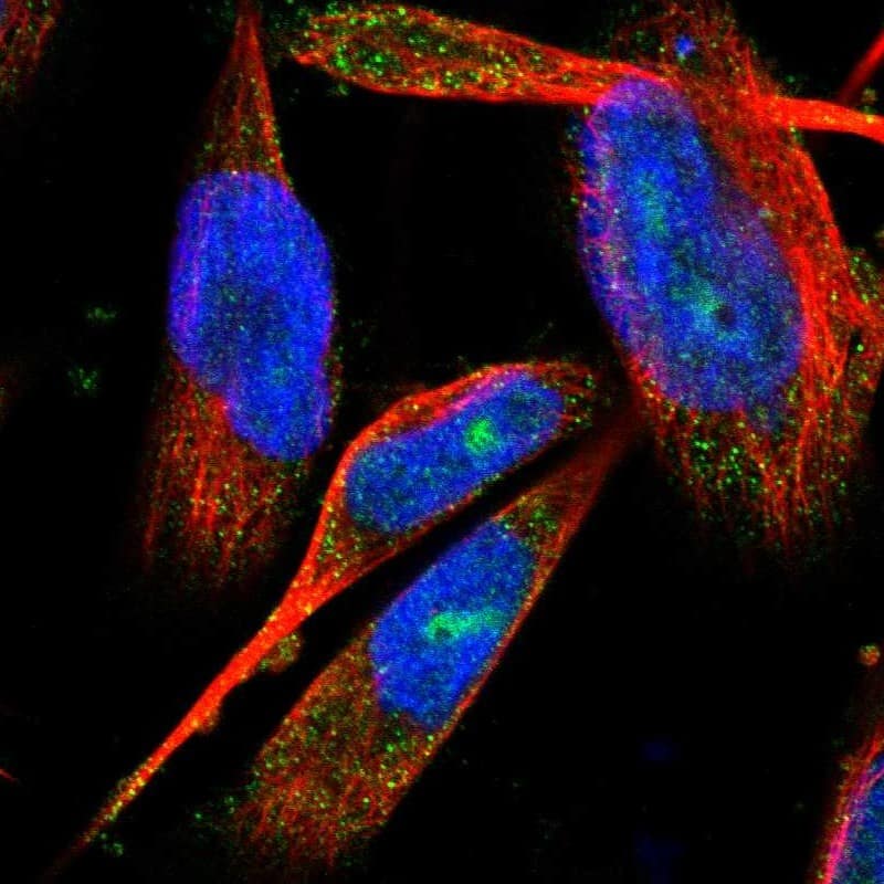 Staining of human cell line U-251 MG shows localization to nucleus, nucleoli & cytosol.