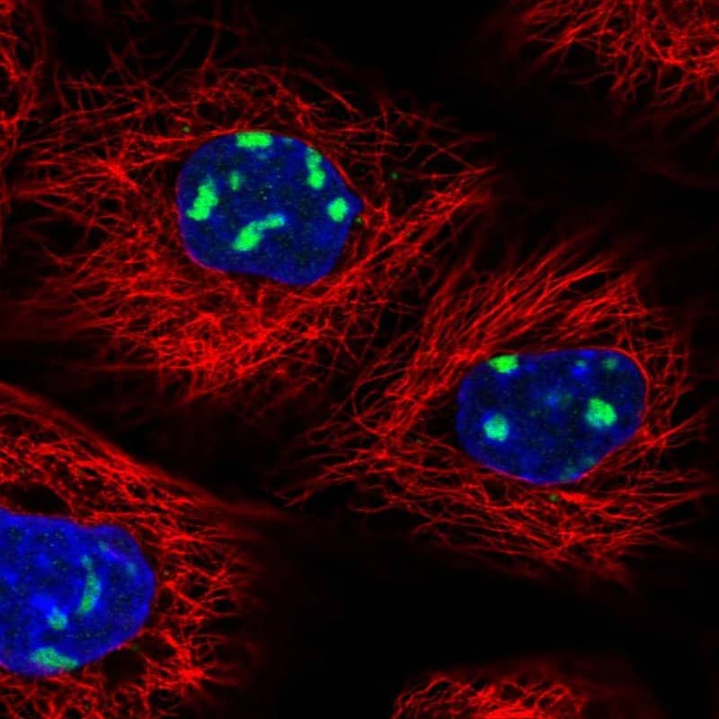 Staining of human cell line A-431 shows localization to nucleoli.