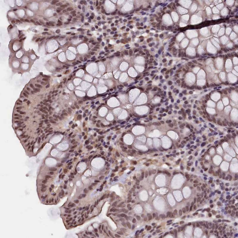 Staining of human colon shows moderate nuclear positivity in glandular cells.