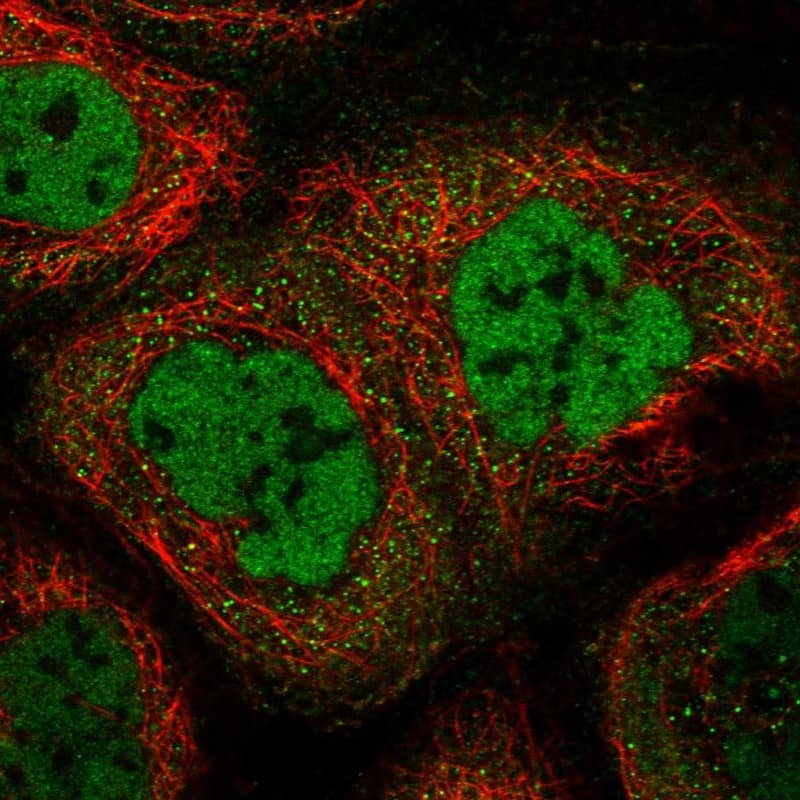 Staining of human cell line A-431 shows localization to nucleoplasm & cytosol.
