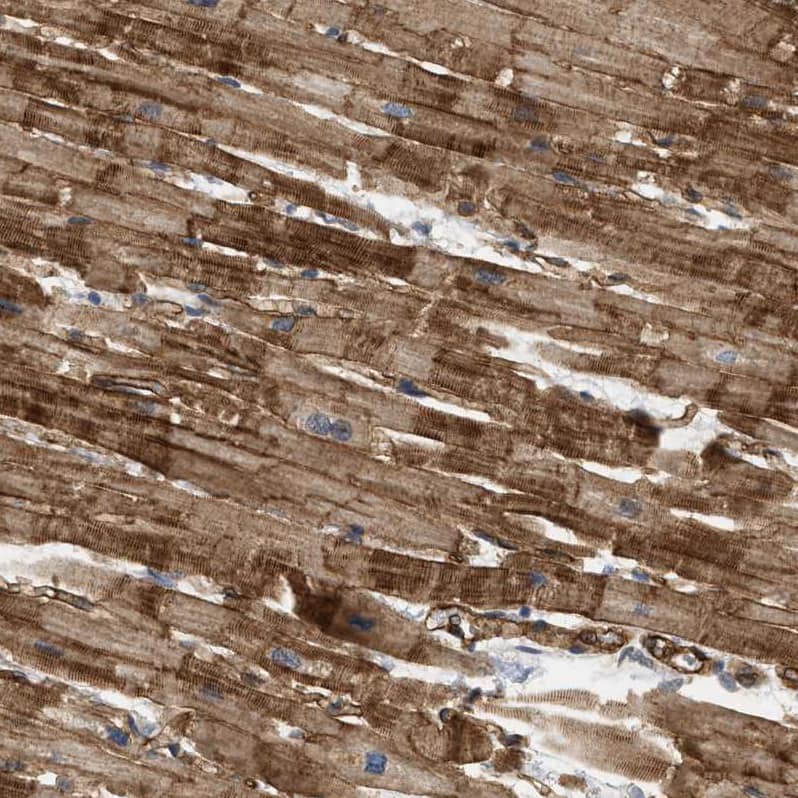 Staining of human heart muscle shows strong cytoplasmic positivity in cardiomyocytes.