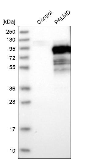Analysis in control (vector only transfected HEK293T lysate) and PALMD over-expression lysate (Co-expressed with a C-terminal myc-DDK tag (~3.1 kDa) in mammalian HEK293T cells).
