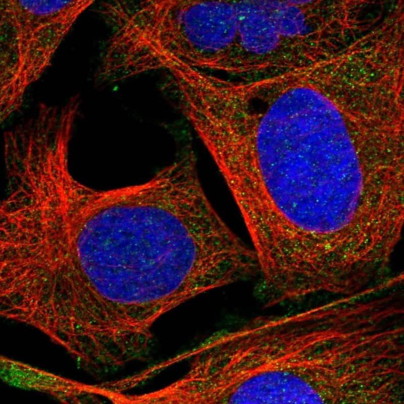 Staining of human cell line U-2 OS shows localization to cytosol.